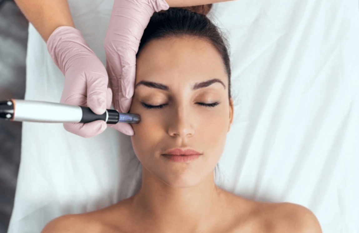 Microneedling med Pen/Dermapen